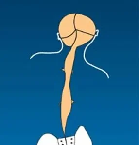 Category I - Pack of 100