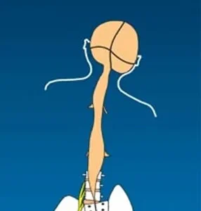 Category III - Pack of 100