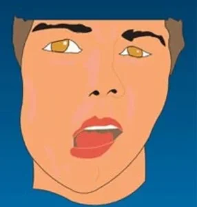 Cranio-Facial Distortion - Pack of 100