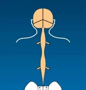 Introduction to SOT - Pack of 100