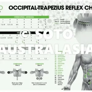 SOTO A CMRT Reflex Chart - A3